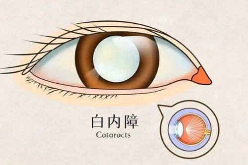 常熟威沃眼科诊所特色项目及技术优势