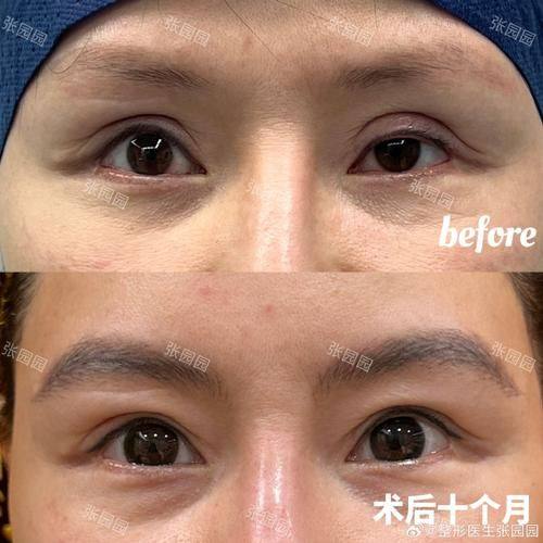 南昌格芮医疗美容门诊部真人口碑评价怎么样？