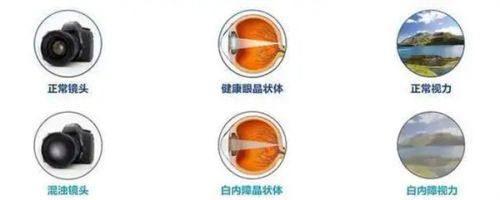 周口眼科医院地址电话营业时间