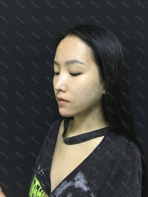 邯郸复之色整形医疗美容门诊部详细的预约挂号方式及流程