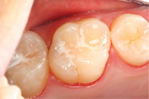 中山品诚口腔诊所特色项目及技术优势