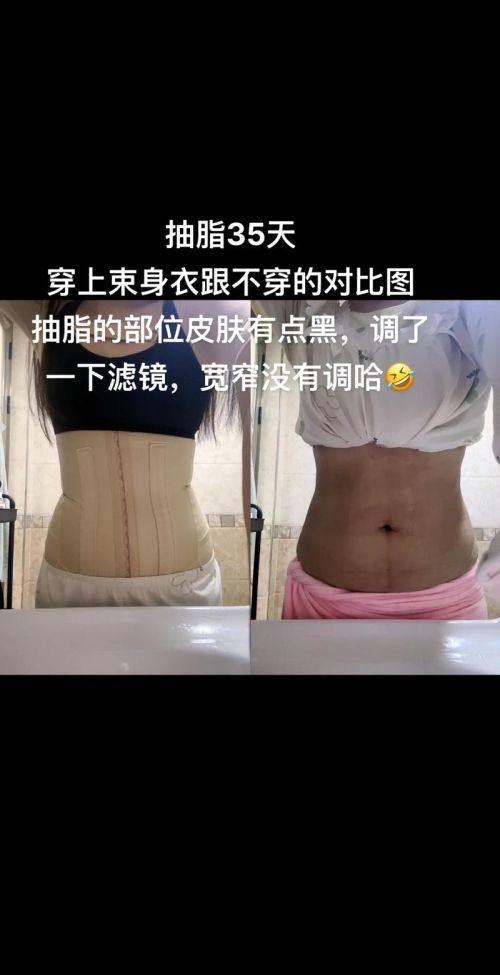 绵阳江油余强白天鹅医疗美容整形诊所特色项目及技术优势