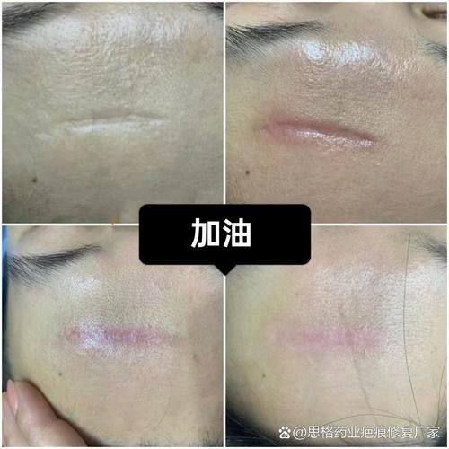 苏州木兰清颜医疗美容诊所详细的预约挂号方式及流程