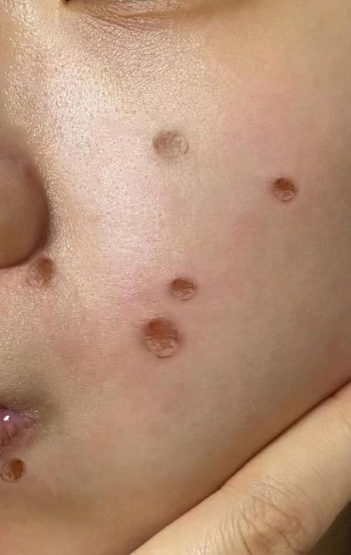 绵阳江油余强白天鹅医疗美容整形诊所收费价格表/收费标准