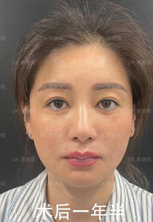 苏州木兰清颜医疗美容诊所收费价格表/收费标准