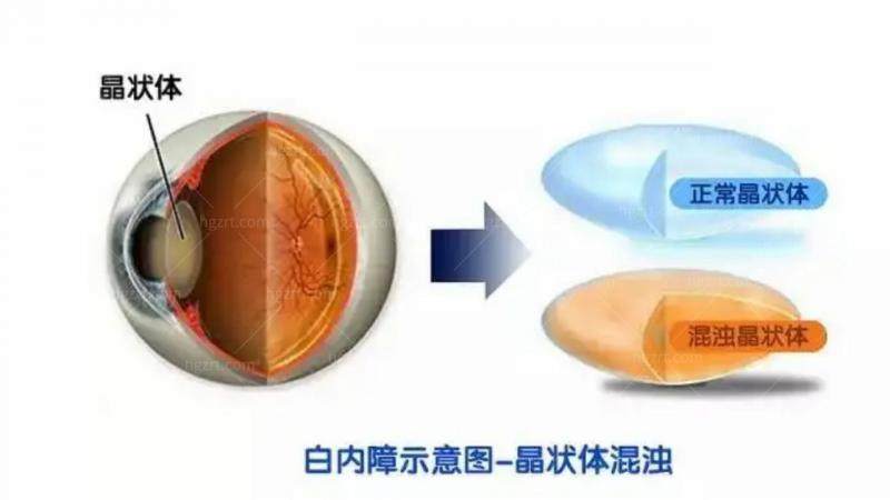 韩国S&B眼科医生团队实力强大及骨干医生简介