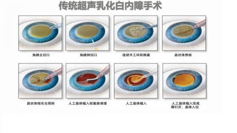 韩国S&B眼科是正规医院吗？