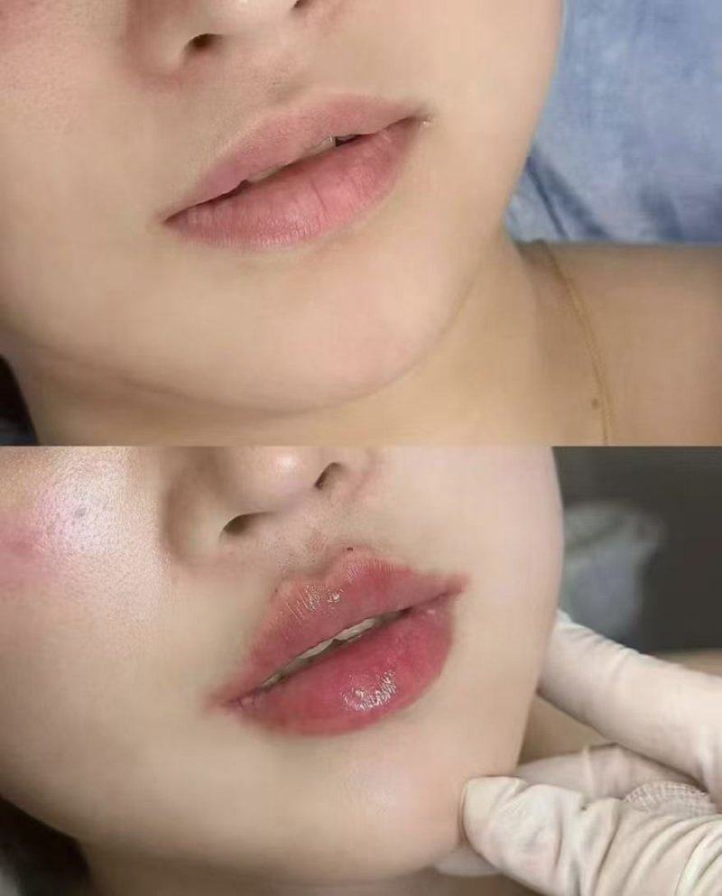 苏州木兰清颜医疗美容诊所真人口碑评价怎么样？