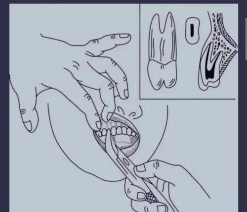 太原恒伦口腔连锁详细的预约挂号方式及流程