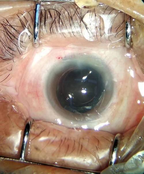 南通大学第二附属医院眼科详细的预约挂号方式及流程