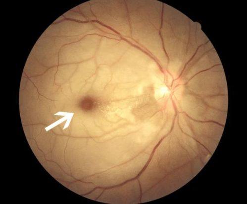 河南科技大学第二附属医院眼科详细的预约挂号方式及流程