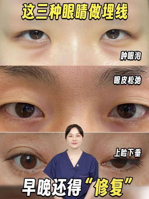 黑龙江哈尔滨艺星医疗美容医院收费价格表/收费标准