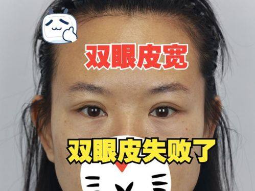 黑龙江哈尔滨艺星医疗美容医院详细的预约挂号方式及流程
