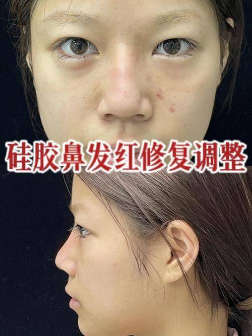 黑龙江哈尔滨艺星医疗美容医院特色项目及技术优势