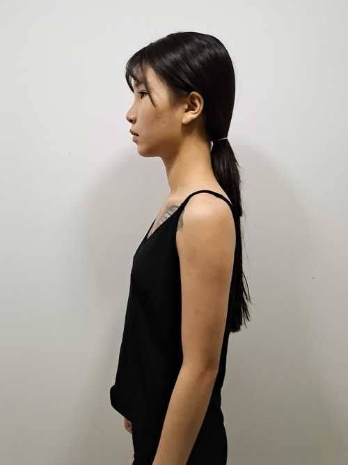 漳州东扬医疗美容诊所收费价格表/收费标准