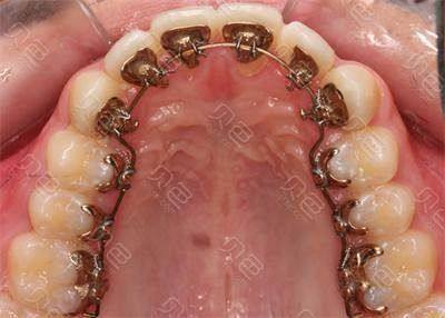 太原恒伦口腔连锁收费价格表/收费标准