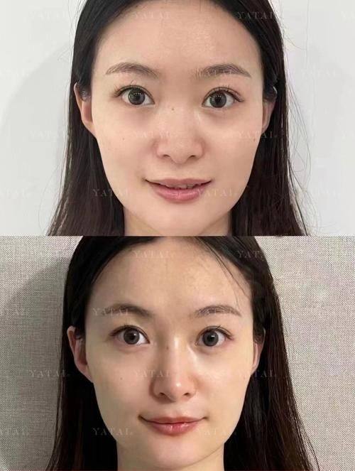 内蒙古唐美医疗美容诊所特色项目及技术优势