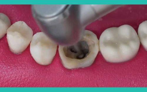 深圳曹显口腔诊所特色项目及技术优势