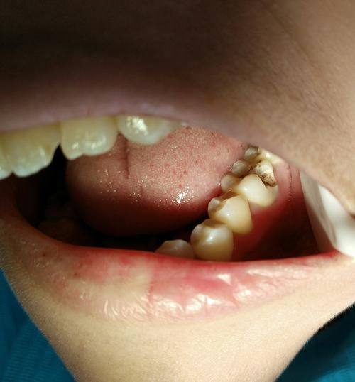 北京和风口腔医院详细的预约挂号方式及流程