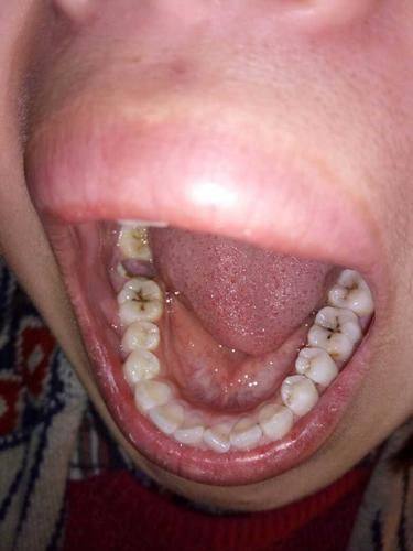 深圳曹显口腔诊所是正规医院吗？