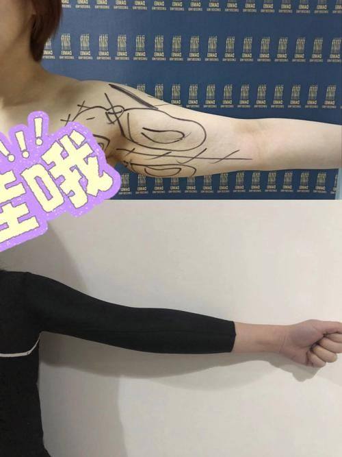 白山苏楠医疗美容诊所真人口碑评价怎么样?