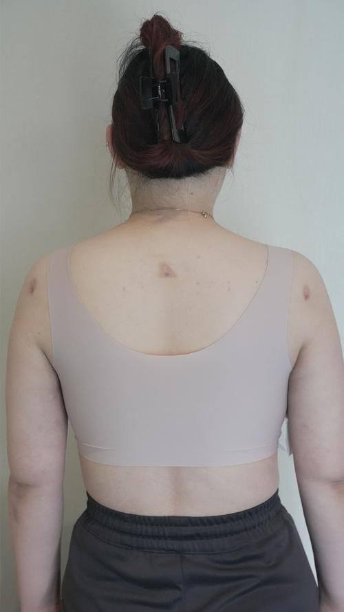 内蒙古唐美医疗美容诊所是正规医院吗？