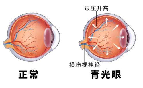 山东亮康眼科医院收费价格表/收费标准