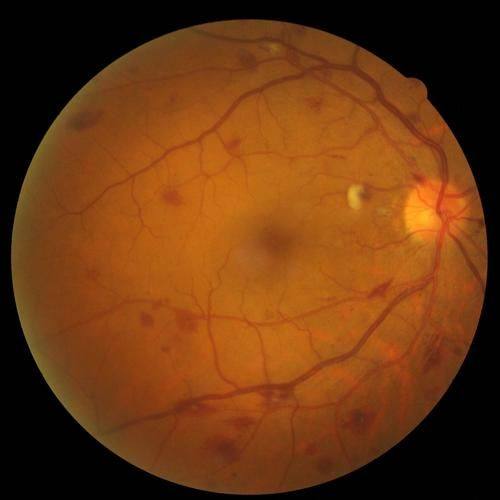 湖州市中医院眼科地址电话营业时间