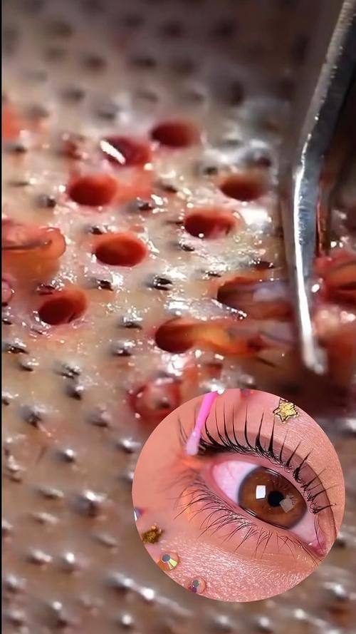 韩国MOEM毛发移植医院详细的预约挂号方式及流程