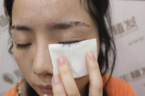 韩国MOEM毛发移植医院地址电话营业时间