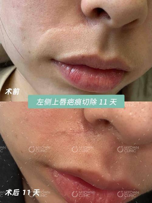 太原白玫瑰医疗美容诊所特色项目及技术优势