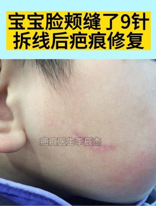 太原白玫瑰医疗美容诊所真人口碑评价怎么样？