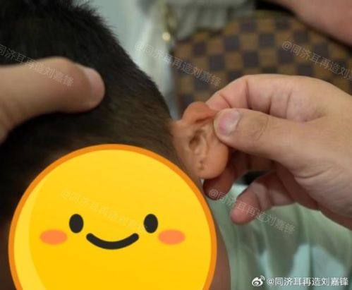 白山苏楠医疗美容诊所特色项目及技术优势