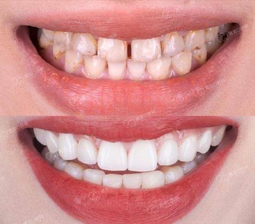 北京和风口腔医院收费价格表/收费标准