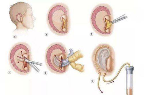 广州伯明翰医疗美容诊所特色项目及技术优势