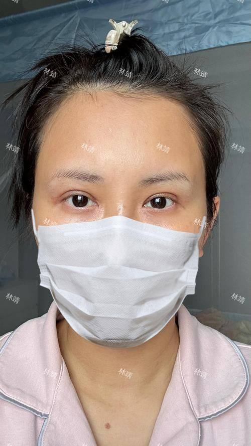 广州伯明翰医疗美容诊所详细的预约挂号方式及流程