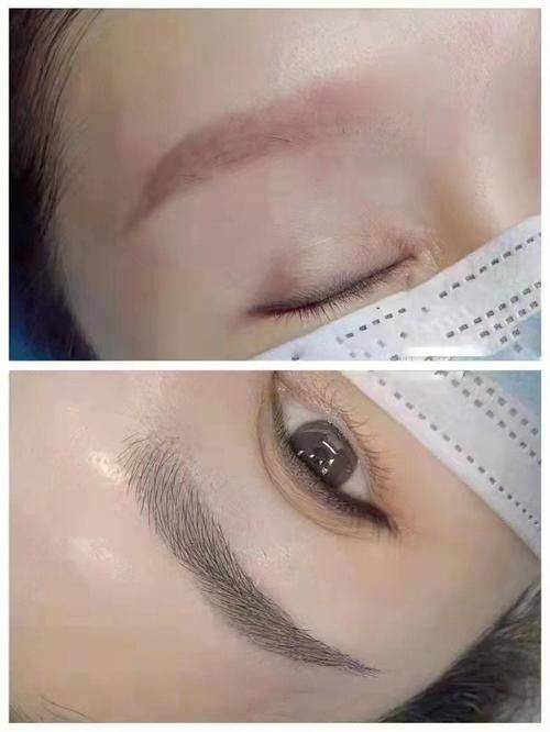 广州伯明翰医疗美容诊所真人口碑评价怎么样？