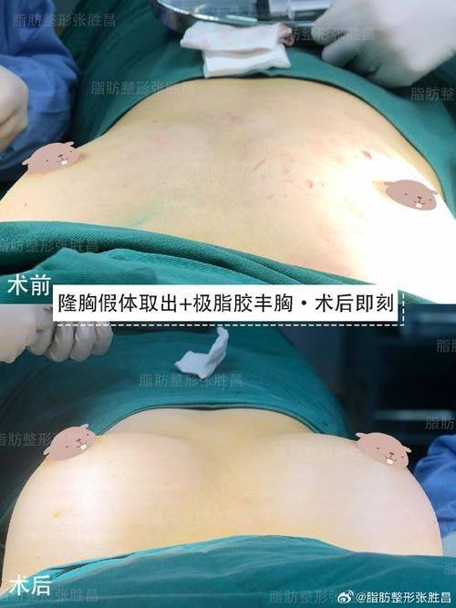 沈阳和平悦美格医疗美容诊所收费价格表/收费标准