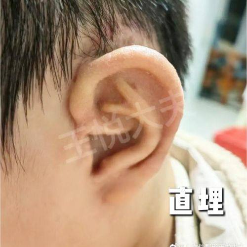 广州伯明翰医疗美容诊所收费价格表/收费标准