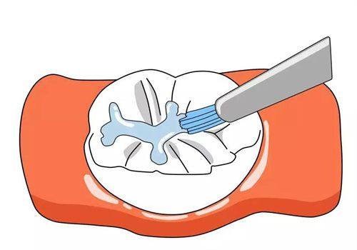 深圳市罗湖区储成华口腔诊所收费价格表/收费标准