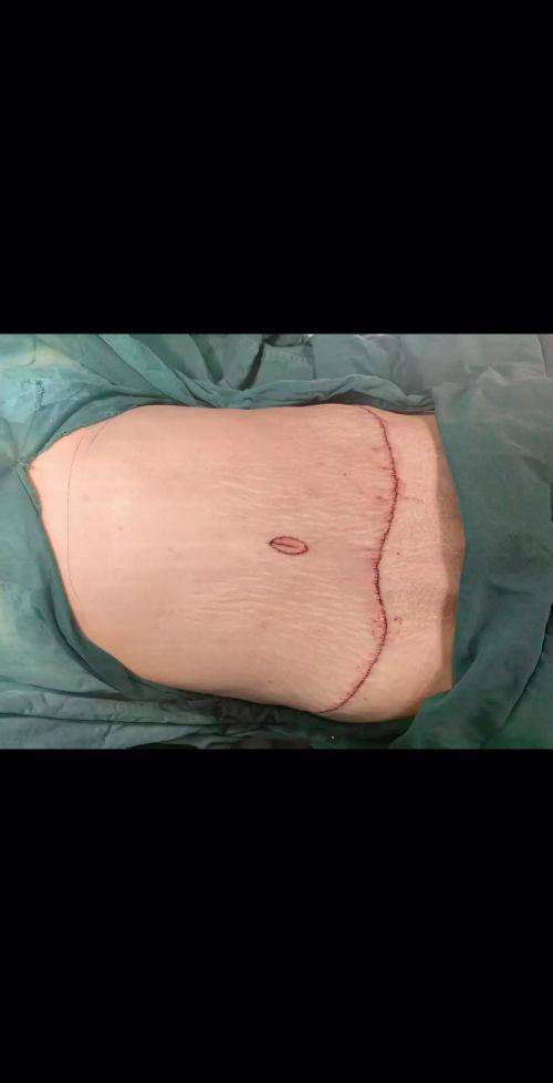 泸州陈清医学整形美容门诊部特色项目及技术优势