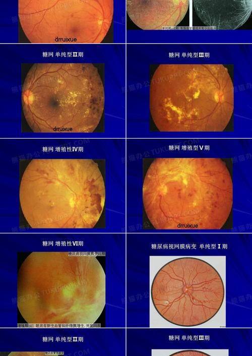柳州红十字会眼科医院是正规医院吗?