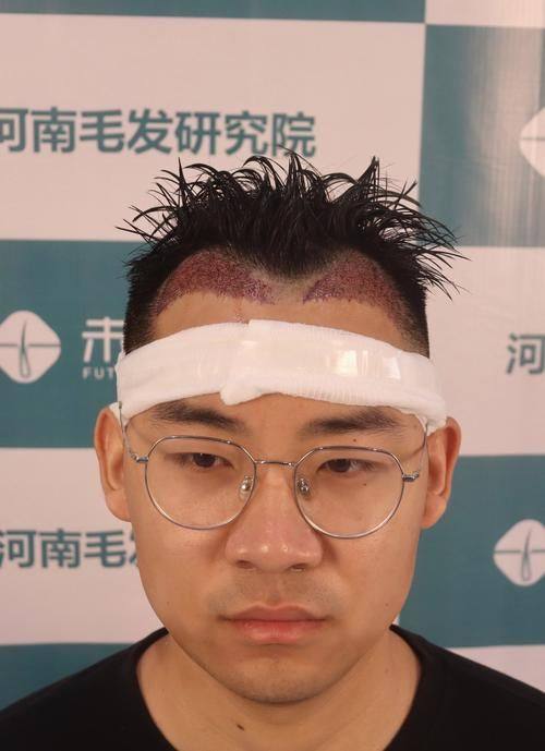 太原市中 心医院整形科特色项目及技术优势