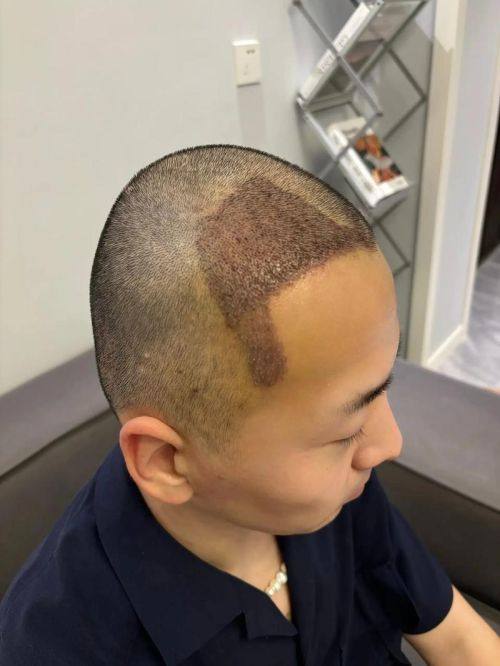 太原市中 心医院整形科是正规医院吗？