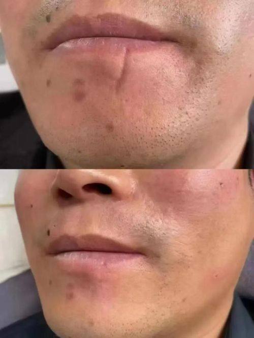 太原市中 心医院整形科真人口碑评价怎么样？