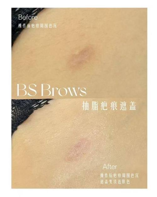 太原市中 心医院整形科收费价格表/收费标准