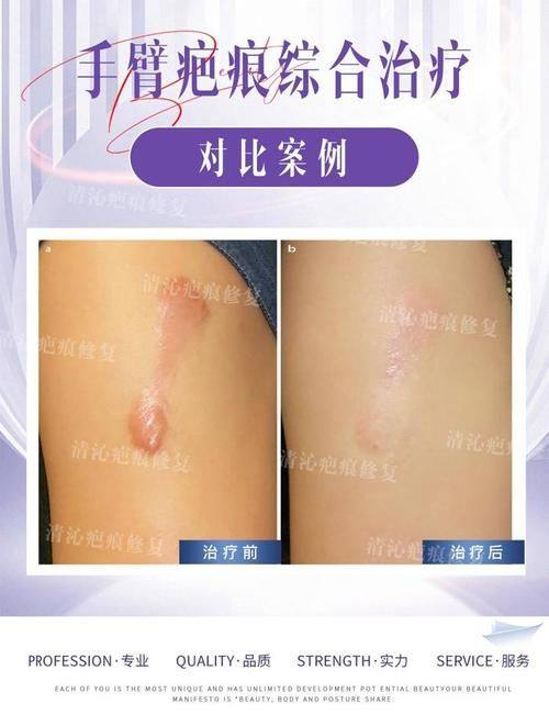 太原市中 心医院整形科详细的预约挂号方式及流程