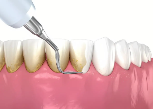 深圳市罗湖区储成华口腔诊所医生团队实力强大及骨干医生简介