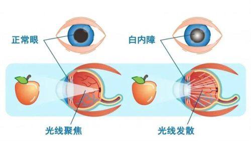 焦作市第二人民医院眼科是正规医院吗?
