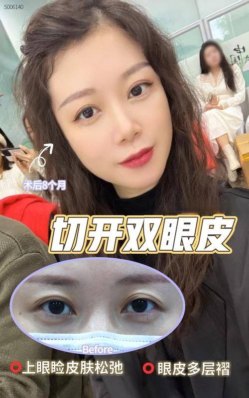 鸡西梁术仙整形医院收费价格表/收费标准